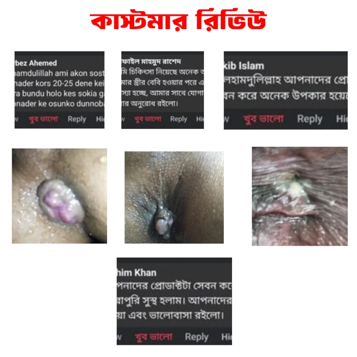 এলিট পিওর পাইলস কেয়ার -১ পিস